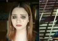 Denizli’de, sosyal medya fenomeni Perihan Kılıçelli balkondan düştü