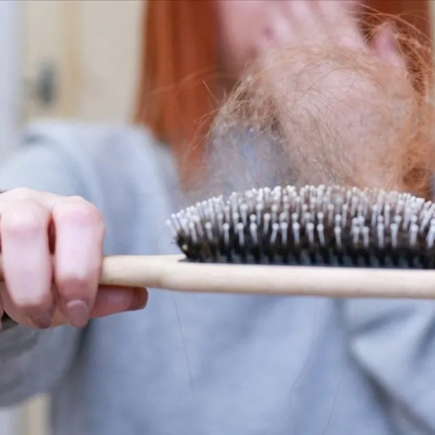 Egzama, kepek, kaşıntı, dökülmeye çare olan tek madde! Bunu yapmak ışıl ışıl saçlara kavuşmak için yeterli