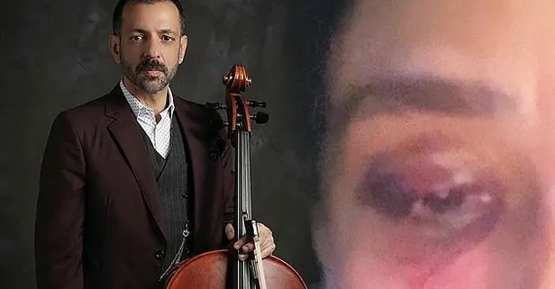 SON DAKİKA: Rubato’nun solistinin şiddet davasında mütalaa! Özer Arkun’un beş yıla kadar hapsi istendi