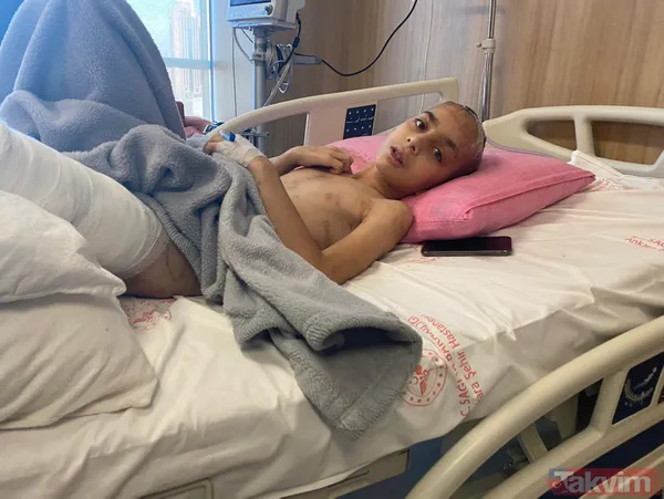 Ankara'da sokak köpeklerinin saldırısının ardından 9 ameliyat geçiren Enes Koca, yeniden yürümeye hazırlanıyor - 2