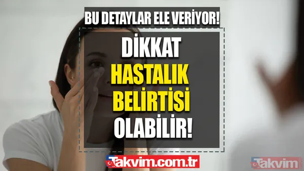 Bu belirtiler sizde de varsa dikkat! Yüzünüz hangi vitamin eksikliğiniz olduğunu söylüyor! - 1