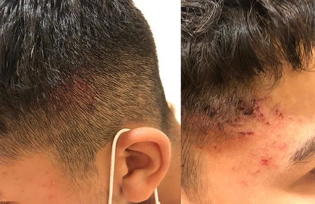 Almanya’da Türk çocuğu Emirhan Altınbaş'a polis şiddeti!-4