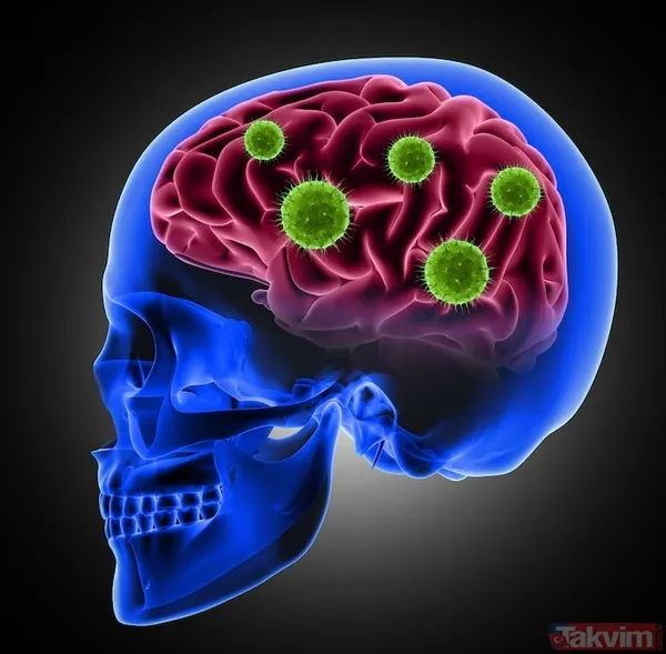 Dr. Mosconi, Özellikle Batı Tipi Beslenme Düzeninin Uzun Vadede Beyin Yapısında Küçülmeye Ve Hücresel Dejenerasyona Yol Açabileceğine Dikkat Çekiyor. Çok...