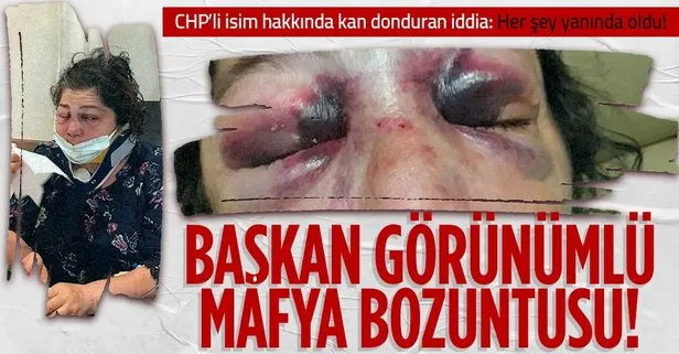 CHP’li Giresun Eynesil Belediye Başkanı Ahmet Latif Karadeniz’in adamları ’parklar bakımsız’ diyen Ülfet Dikici’yi hastanelik etti!