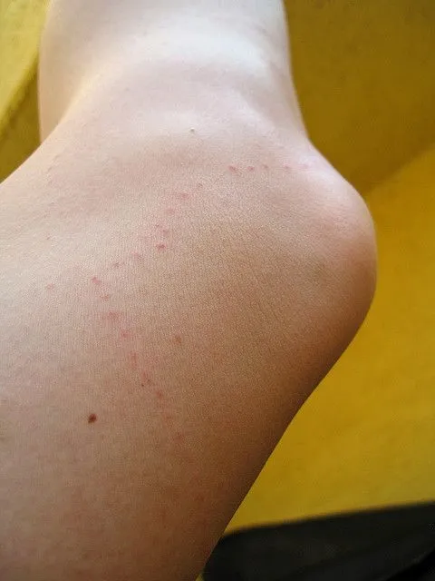 marmara-denizine-girenler-dikkat-gorulmeye-baslandi-uzmanlar-alarm-veriyor-1720019505905.jpg ALARM VERİLDİ: Görülmeye başlandı! Marmara denizine girenler dikkat!-5