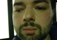 Almanyada Türk iş adamı Alman polisi tarafından darbedildi