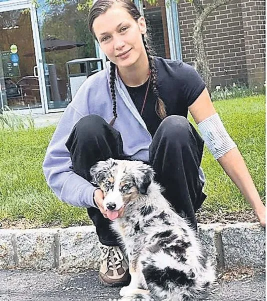 bellali-hastalik-1691441994385.jpeg Bella Hadid’in Lyme hastalığı için tedavi gördüğü ortaya çıkmıştı! O anlarını paylaştı...-2