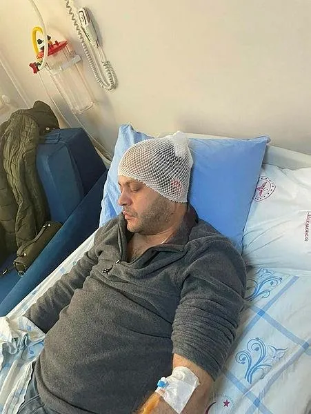 Kafasına mermerle öldüresiye vurulan doktora 8 dikiş atıldı! Yer: Gaziantep-2