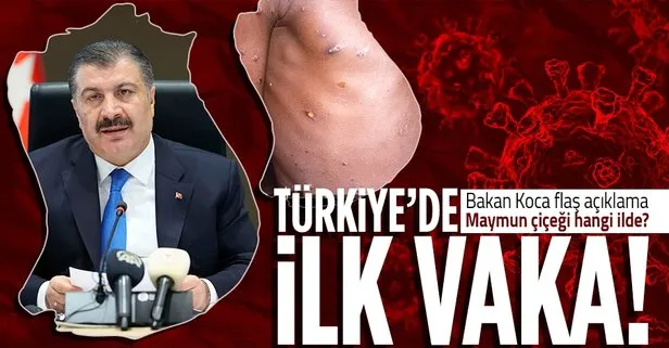 Bakan Koca’dan flaş maymun çiçeği açıklaması! Türkiye’de ilk vaka