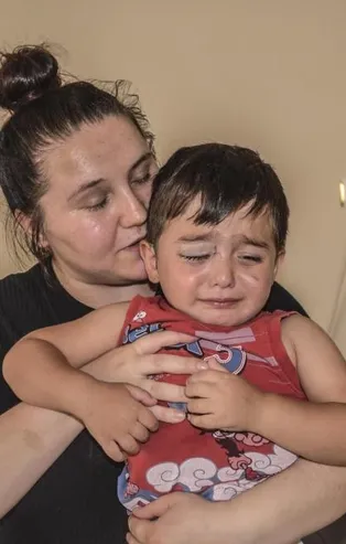 Köpeklerin saldırısına uğrayan 3 yaşındaki çocuk neredeyse gözünden oluyordu