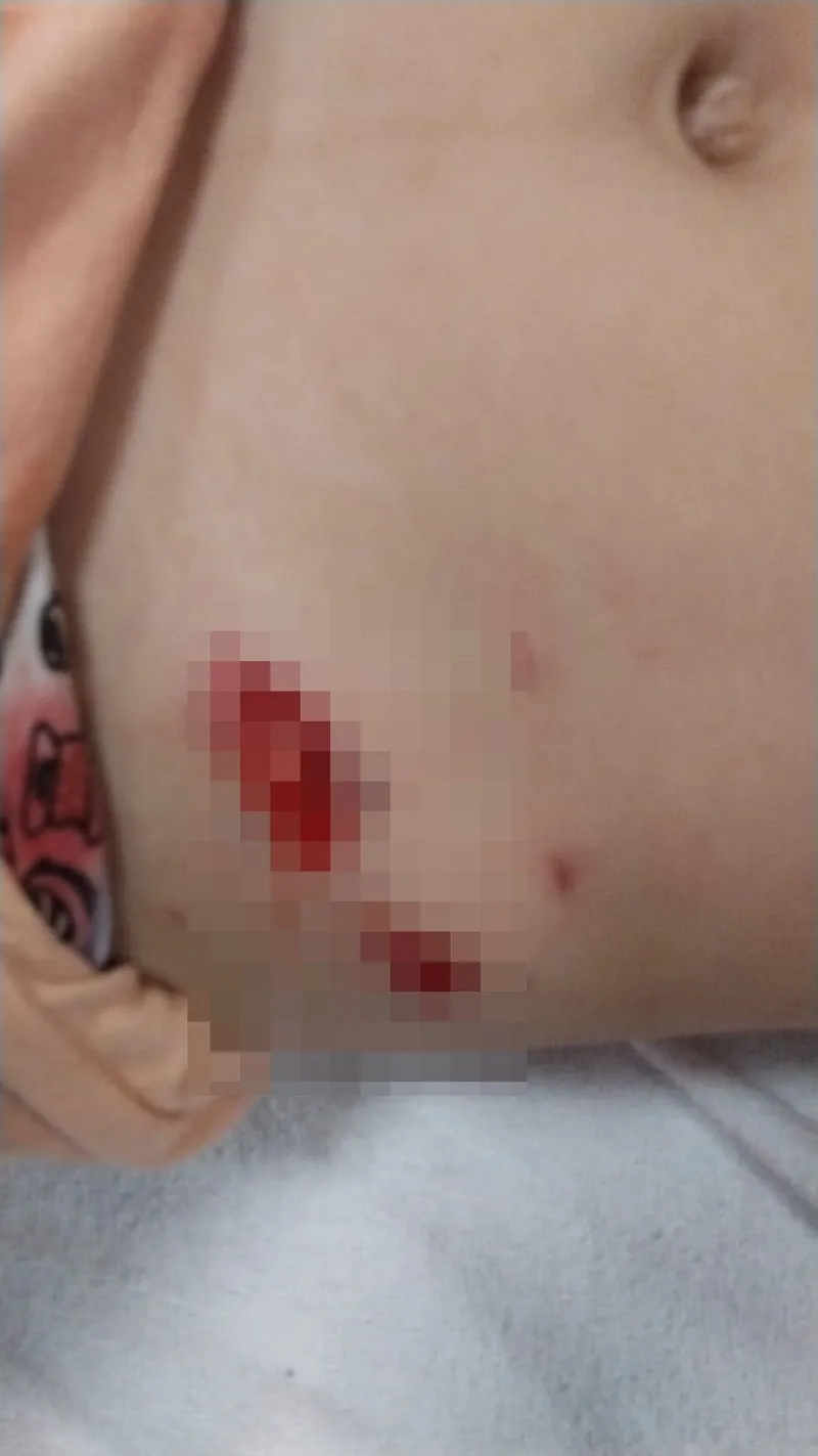 ankarada-basibos-kopekler-bu-kez-5-yasindaki-cocu-1724424396718.jpg Bir başıboş köpek vakası da Ankara Gölbaşı'nda: 5 yaşındaki çocuğu sürükleyip yaraladı-3