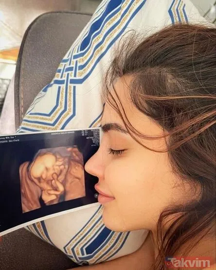 Mehmet Ali Erbil'in tacizini ifşa etmişti! Karnı burnunda olan Ece Ronay hem alttan hem üstten açtı o pozuna yorum yağdı: "Sen Rihanna mısın?" - 13