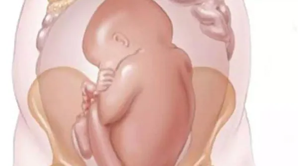 ters-dogum-nedir-dogum-kocu-evde-dogum-yaptirdi-ters-gelen-bebek-oksijensizlikten-oldu-1641993097494.jpg Ters doğum nedir? Doğum koçu evde doğum yaptırdı! Ters gelen bebek oksijensizlikten öldü-9