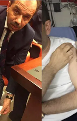 AK Parti'li vekil raporla ısırıldığını ispatladı