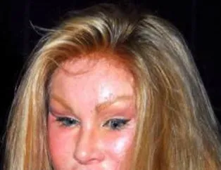 En Çirkin Ünlüler