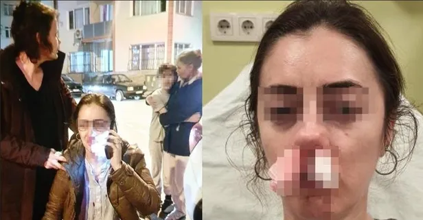 Kıskançlıktan gözü döndü yanlış kadını darbetti