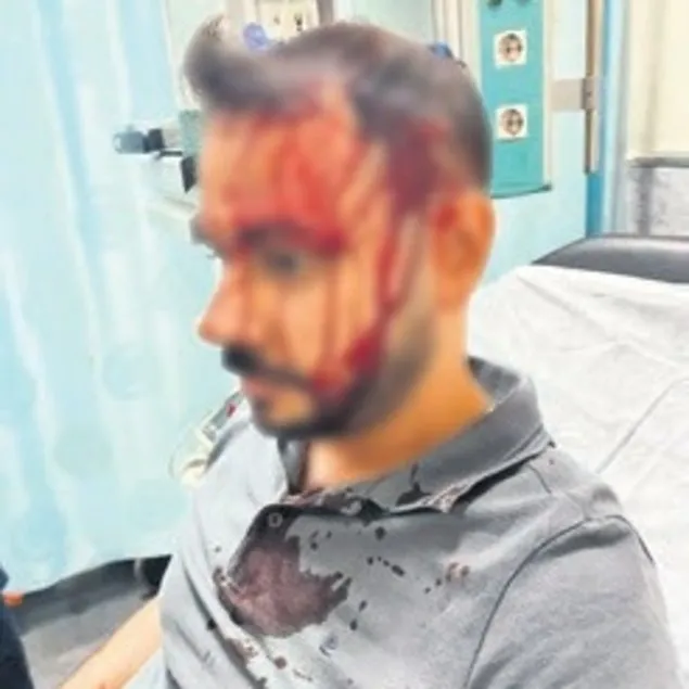Terapiyi bıraktı şiddeti seçti