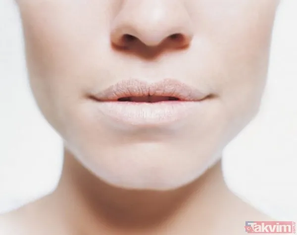 Bu belirtiler sizde de varsa dikkat! Yüzünüz hangi vitamin eksikliğiniz olduğunu söylüyor! - 9