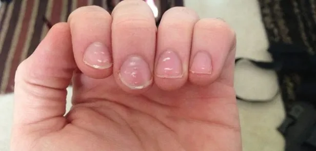 tirnaklardaki-beyaz-cizgilerin-nedeni-meger-buymus-herkes-farkli-biliyordu-meger-1697460597194.jpg Tırnaklardaki beyaz çizgilerin nedeni meğer buymuş! Herkes farklı biliyordu: Duyunca çok şaşıracaksınız!-10