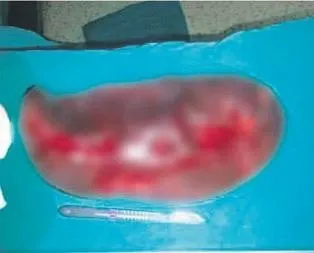 Sahibinden acil satılık dalak!