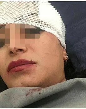 akondroplazi-tanisiyla-mucadele-veren-metehan-bebek-saglik-bakanliginin-voxzogo-adli-ilac-sayesinde-umudu-artt-1643670289988.jpeg Akondroplazi tanısıyla mücadele veren Metehan Bebek Sağlık Bakanlığı’nın “Voxzogo” adlı ilaç sayesinde umudu arttı-14