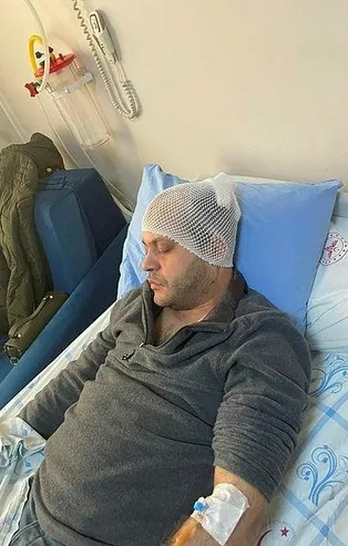 Kafasına mermerle öldüresiye vurulan doktora 8 dikiş atıldı! Yer: Gaziantep