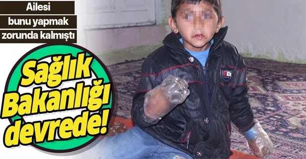 Sağlık Bakanlığı, ısırmasın diye ellerine pet şişe geçirilen küçük Yusuf için harekete geçti!