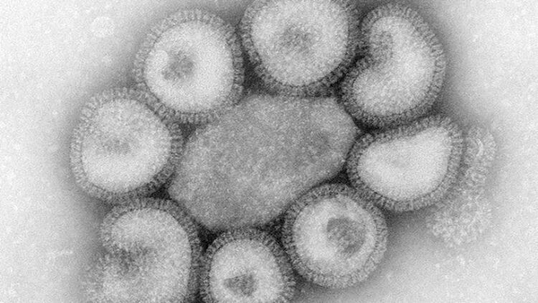 24-saatte-olduruyor-cinde-gorulen-bubonik-veba-nedir-bubonik-veba-belirtileri-nelerdir-1601448249434.jpg 24 saatte öldürüyor! Çin’de görülen Bubonik veba nedir? Bubonik veba belirtileri nelerdir?-3