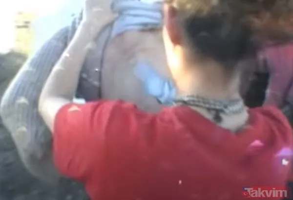 Karnındaki şişlik için gitti içinden çıkan doktorları bile şoke etti! Yer uzak değil Kayseri! 64 kilo girdi 55 kilo çıktı - 8