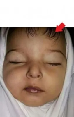 Afrin yalanlarında bugün