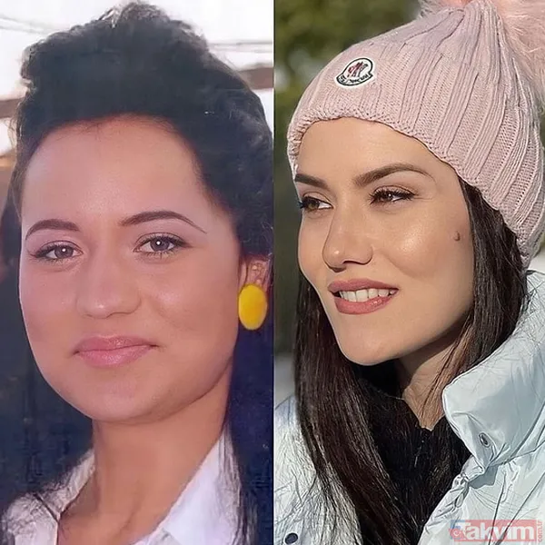 Yeşilçam’ın Sultan’ı Türkan Şoray'ın kızı Yağmur Ünal’ın son haline bakın! Botokstan konuşamadı! Gören şaştı kaldı - 10