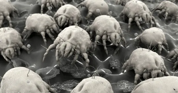 Vücudumuzda geziyor! 8 bacaklı, korkunç... Uyuz böceğinin şeklini şemalini hiç gördünüz mü?