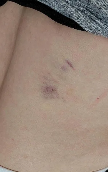 Anneler gününde kayınvalidesine faciayı yaşattı! Eve giren kadını dakikalarca dövdü-5