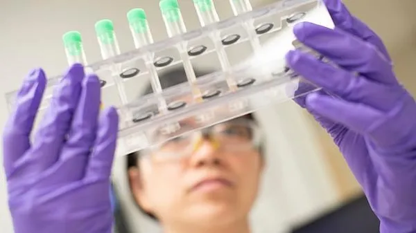 Koronavirüsün son hali görenleri korkuttu! Kıla benzer enfekte hücreler...-1