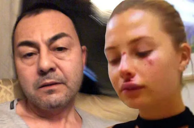 Serdar Ortaç'ın eşi Chloe Loughnan'a Süreyya Yalçın sahip çıktı