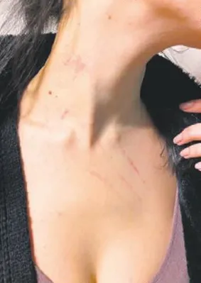 İstanbul Beşiktaş'ta 5 yıldızlı otelde sapık paniği! "Tek biz değiliz, başka kızlar da var..."-3