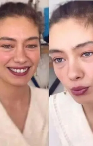Hastalığı nedeniyle 'Sefirin Kızı' dizisinden ayrılmak zorunda kalmıştı! Neslihan Atagül'ün son hali hayranlarını üzdü