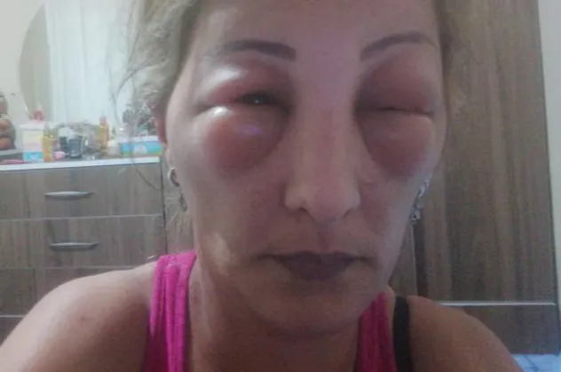 Yalova'da saçlarına boya yaptırmak isteyen kadın canından oluyordu