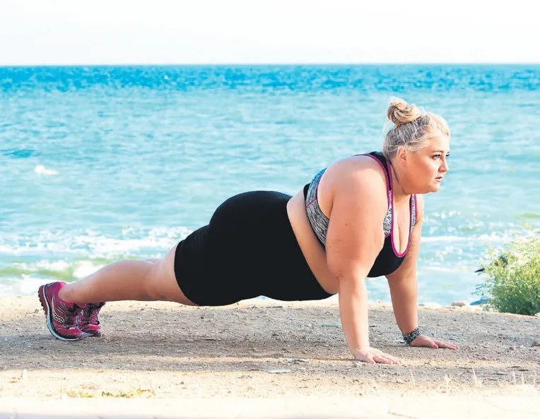 Obezite değil, lipödem: Kadınlarda sık ama fark edilmiyor-3