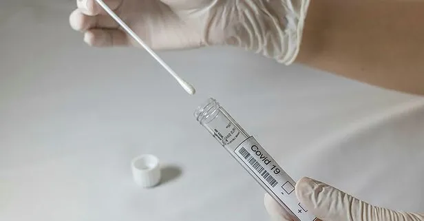 15 saniyede koronavirüs testi! Türk bilim insanları üretti