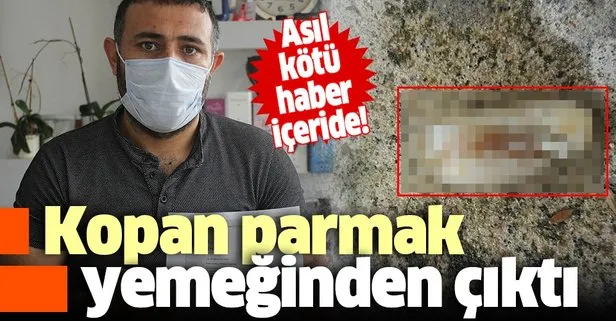 İşçinin yemeğinden kopmuş parmak çıktı