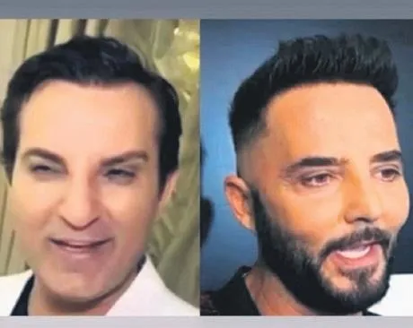 rafet-el-romandan-sonra-gokhan-ozen-de-goruntusuyle-sasirtti-unlu-sarkici-sosyal-medyanin-diline-dustu-1705446756080.jpeg Rafet El Roman’dan sonra Gökhan Özen de görüntüsüyle şaşırttı! Ünlü şarkıcı sosyal medyanın diline düştü-3