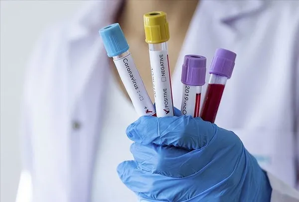 Singapurlu bilim insanlarından korkutan koronavirüs açıklaması! "Etkisi 20 yıl sürebilir"-2