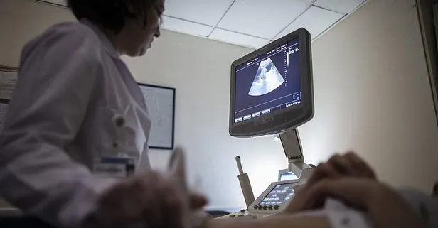 9 kiloluk miyom şaşkınlık yarattı