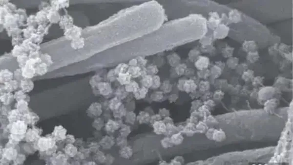 Koronavirüsün son hali görenleri korkuttu! Kıla benzer enfekte hücreler...-4