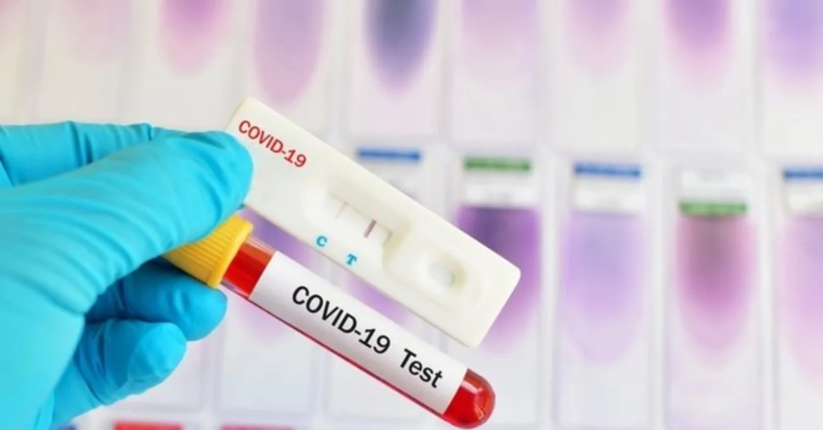 Pcr Testi Nedir Pcr Testi Nasil Nerede Yapilir Takvim