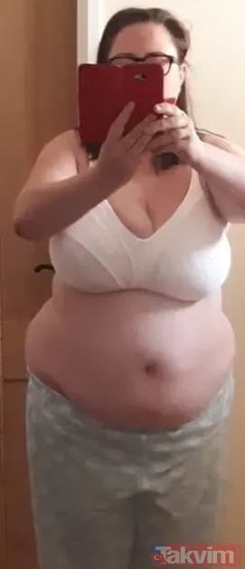 Ozempic'le 45 kilo verdi! İki yıldır tek gram almamasını sağlayan sırrı açıkladı - 5