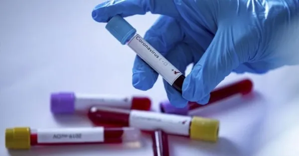 Türkiye'de bir ay sonra korkutan rakam! 1500 vakanın etkisi...-10