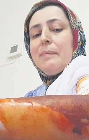 Karabük'te cani koca, eşini kaynar suyla haşladı