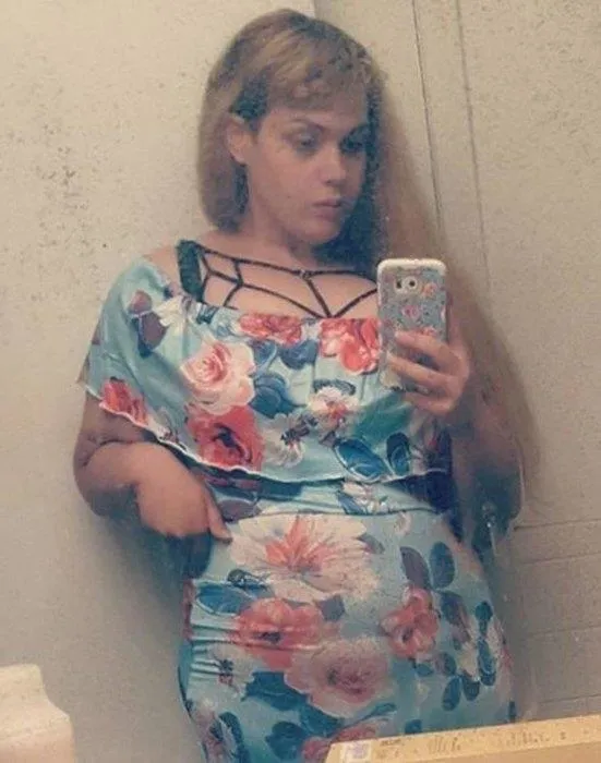 300 kiloya ulaşmıştı! Son hali şaşırttı-14